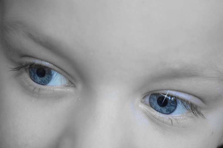 Les maladies liées à l'œil chez le nourrisson Prendre soin de la vision dès le plus jeune âge